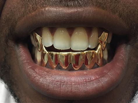 Grillz 10k 14k 18k 22k pull out and permanent yellow gold, white gold, rose gold. 6 Bottom $150 Grillz Gold Teeth Jewelry for sale in Miami, FL - 5miles: Buy and Sell