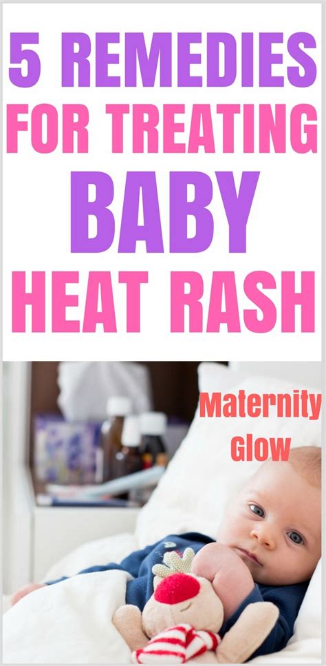 Baby Heat Rash Remedies Baby Heat Rash Treatment Preventing Baby