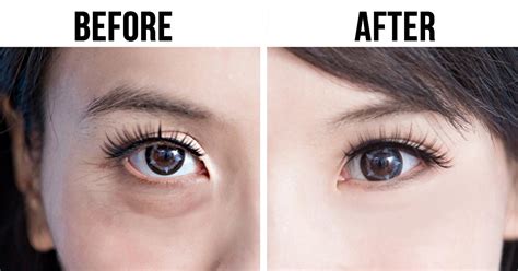 An Awesome Japanese Technique To Make Your Eyes Look Younger — It Only