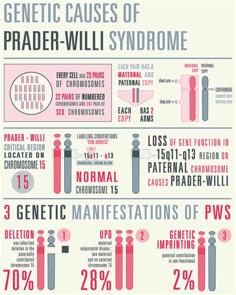 Prader Willi Syndrome Cause Symptoms Diagnosis Treatment