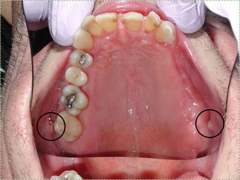 Histology And Embryology For Dental Hygiene