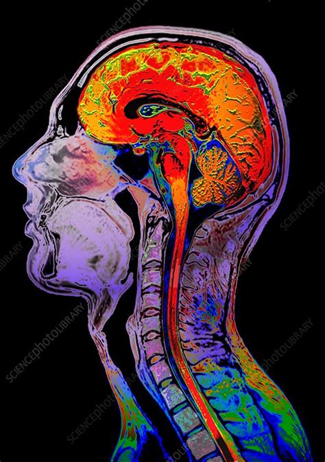 But a new study challenges that, showing. Normal brain, MRI scan - Stock Image C001/7911 - Science ...