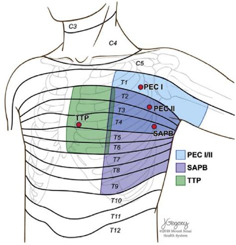 Illustration Of The Chest Wall Anatomy Including Suggested Regional