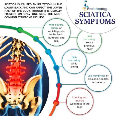 What Are The Symptoms Of Sciatica Facts About Sciatica Infographic