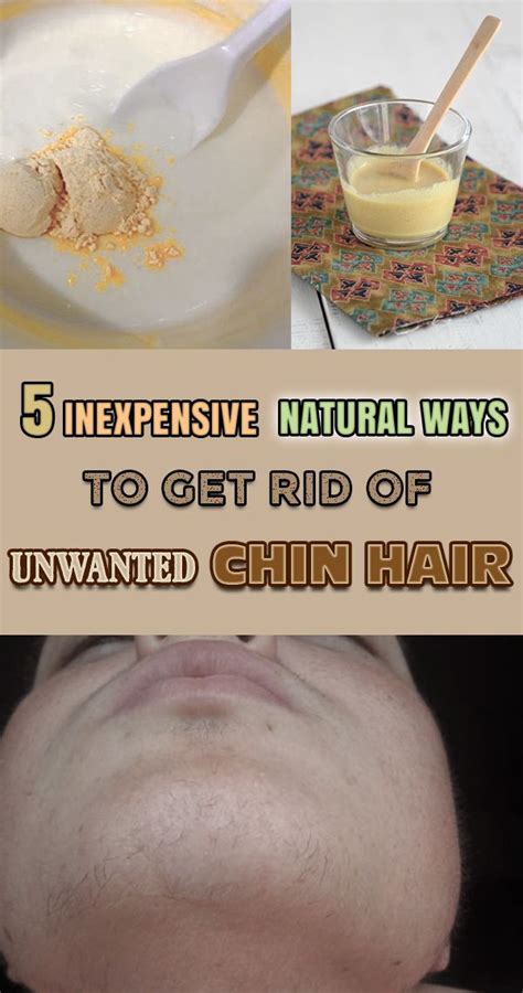 5 Inexpensive Natural Ways To Get Rid Of Unwanted Chin Hair Chin Hair
