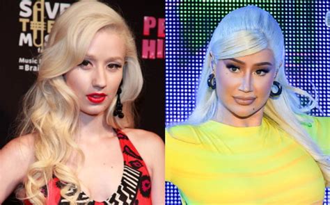iggy azalea s plastic surgery glow up has sparked a cosmetic surgery debate