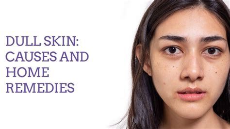 Dull Skin Causes And Home Remedies Skin Care Top News