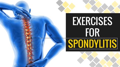 5 Minute Exercise To Get Rid Of Spondylosis And Neck Pain Truweight