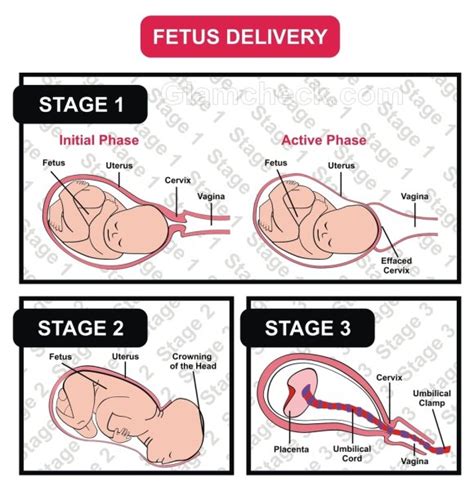 Labor And Delivery Stages Of Labor