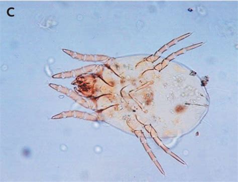 Ear Mites Case A Rarity Report Finds Live Science