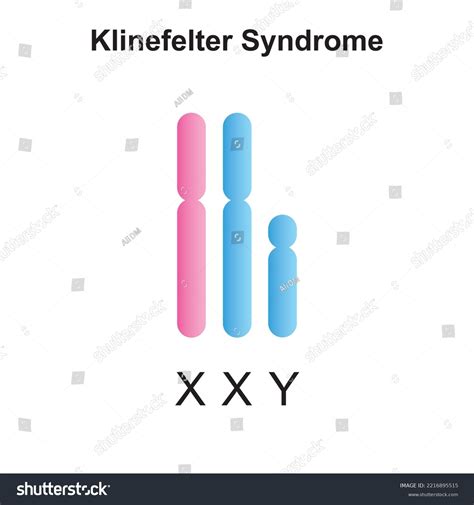 Scientific Designing Klinefelter Syndrome Xxy Colorful Stock Vector