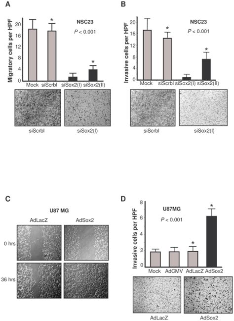 A Assessment Of Cell Migration Of Sox2 Silenced Btscs Sox2 Regulates