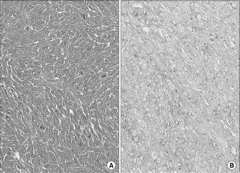 Figure 1 From Long Term Survival Following Surgical Resection For