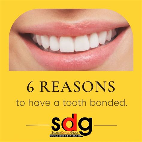 Dental Bonding 6 Reasons To Get A Tooth Bonded Sachem Dental Group
