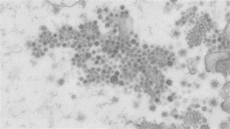 Covid Virus Images Shared For Global Science Community University Of