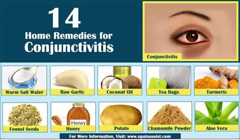 6 Things To Know About Conjunctivitis In Children Pink Eye Page 4