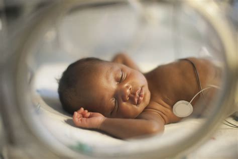 Very Premature Baby Health Conditions