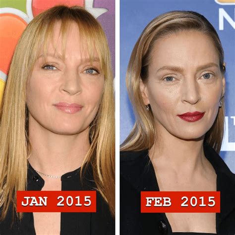 Uma Thurman Before And After Plastic Surgery 04 Celebrity Plastic