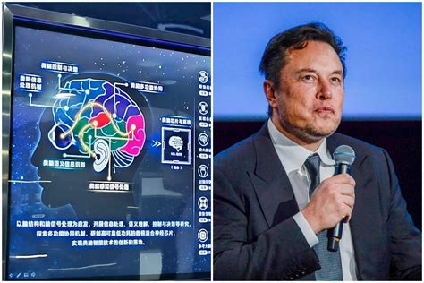 Un Premier Patient Reçoit Un Implant Cérébral De Neuralink La Société
