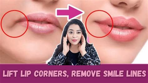 Lift Lip Corners Fix Droopy Mouth Corners Fat Around The Mouthsagging Cheeksno Surgery
