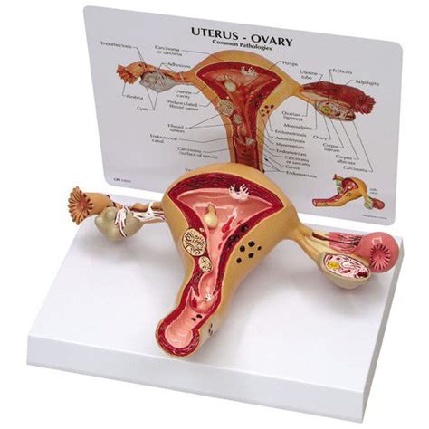 Anatomisches Modell Gebärmutter 3480 GPI Anatomicals Ovarien