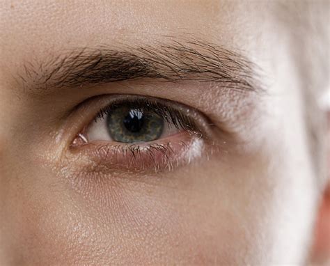 Eczema On The Eyes Eczema Foundation