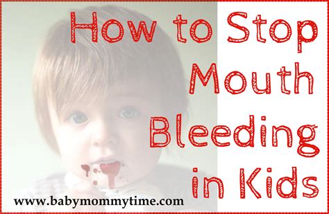 How To Stop Mouth Bleeding In Kids Home Remedies Babymommytime