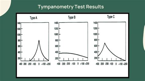 What Does A Tympanometry Test Do Should I Get One