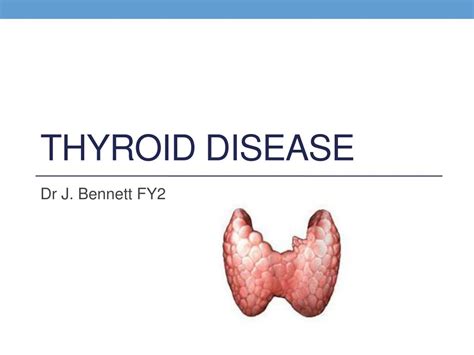 Ppt Thyroid Disease Powerpoint Presentation Free Download Id2132906