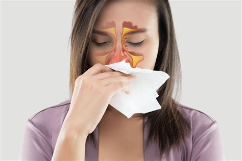 Apa Itu Sinusitis Dan Cara Mengobatinya