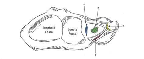 Open And Arthroscopic Triangular Fibrocartilage Complex Tfc Jaaos