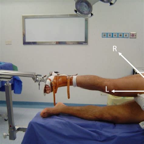 Patient Positioning For Hip Arthroscopy With The Patient On His Left