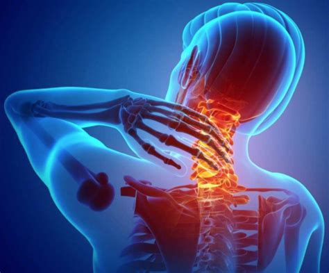 Neck Pain Clinical Practice Guidelines Physiopedia