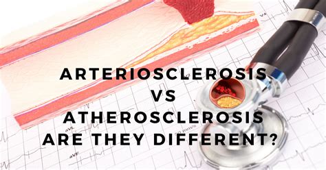 Arteriosclerosis Vs Atherosclerosis Are They Different Healthnactive