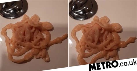 Man Pulls Moving Tapeworm Out Of His Own Backside Metro News