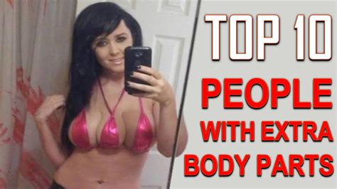 Top 10 People With Extra Body Parts Youtube
