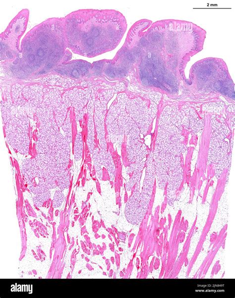 Human Lingual Tonsil Light Micrograph Stock Photo Alamy