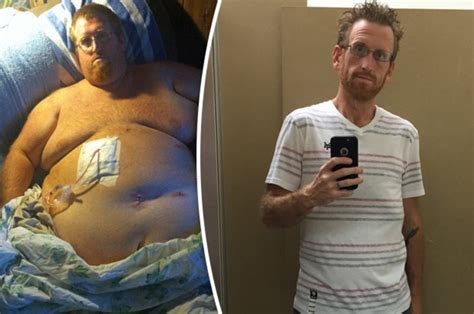 Man Makes Miraculous Weight Loss Transformation After 33st Figure