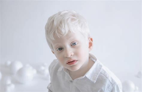 Photographer Captures Stunning Portraits Of Albino People And Its The