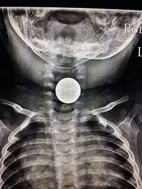 Pin On Unusual X Rays