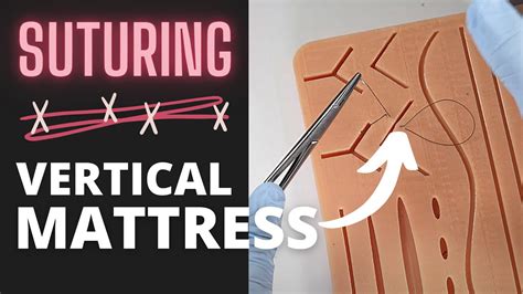 Mastering The Vertical Mattress Suture Youtube
