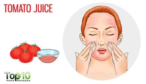 How To Get Rid Of Bumps On Forehead Forehead Bumps Forehead Juice Mask