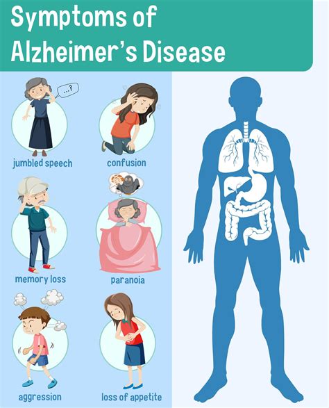 Symptoms Of Alzheimers Disease Infographic 1503907 Vector Art At Vecteezy