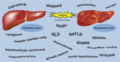 Signaling Pathways In Liver Disease