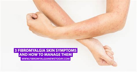 3 Fibromyalgia Skin Symptoms And How To Manage Them Fibromyalgia News