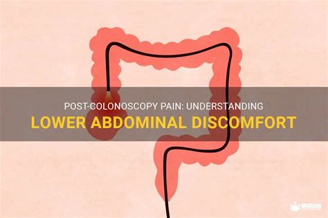 Post Colonoscopy Pain Understanding Lower Abdominal Discomfort MedShun