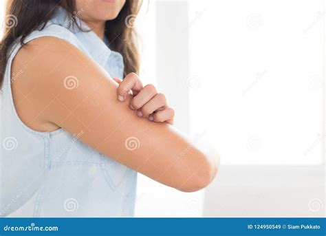 Close Up Woman Arm Scratch The Itch By Hand At Home Healthcare Stock