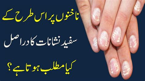 What Vitamin Deficiency Causes White Spots On Your Nails Raaztv Youtube