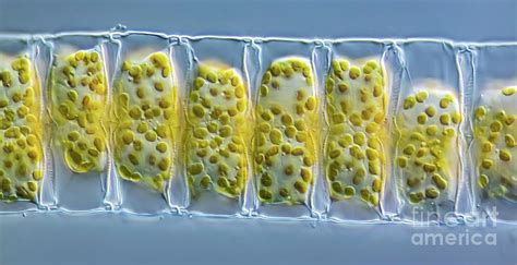 Bellerochea Malleus Diatoms Photograph By Gerd Guentherscience Photo