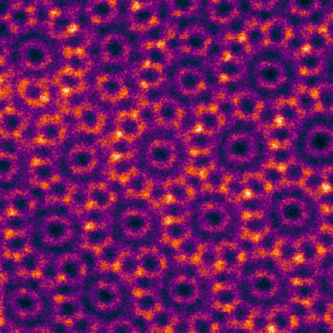 Electron Microscope Images Atom